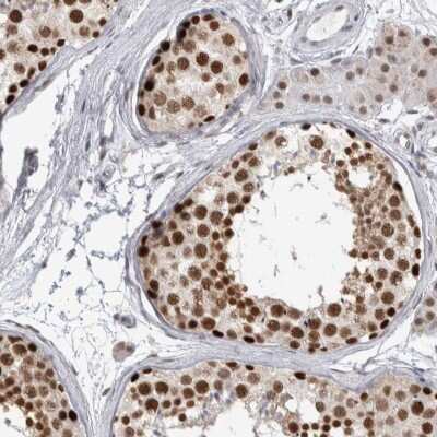 Immunohistochemistry-Paraffin: HEXIM2 Antibody [NBP1-93876]