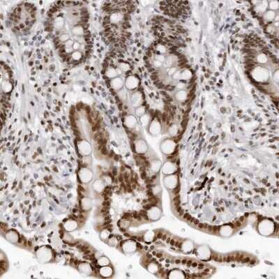 Immunohistochemistry-Paraffin: HEXIM2 Antibody [NBP1-93877]