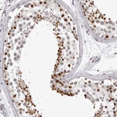 Immunohistochemistry-Paraffin: HEXIM2 Antibody [NBP1-93877]