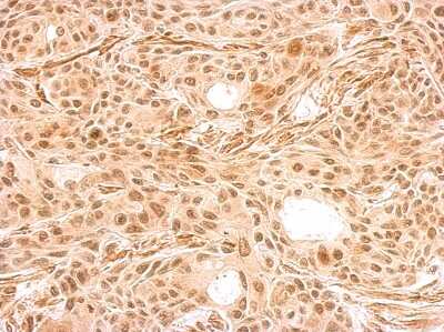 Immunohistochemistry-Paraffin: HEXIM2 Antibody [NBP2-16812]
