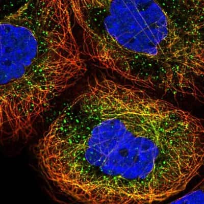 Immunocytochemistry/ Immunofluorescence: HEXO Antibody [NBP2-38756]