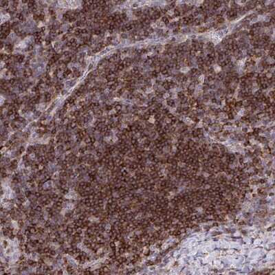 Immunohistochemistry: HEXO Antibody [NBP2-38782]