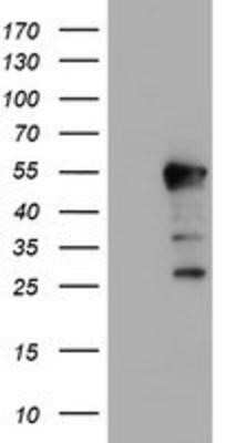 Western Blot: HEXO Antibody (OTI1B3) [NBP2-01655]