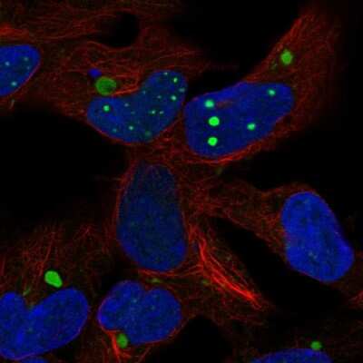 Immunocytochemistry/ Immunofluorescence: HEY2 Antibody [NBP2-57809]