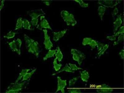 Immunocytochemistry/ Immunofluorescence: HFE Antibody (1G12) [H00003077-M01]