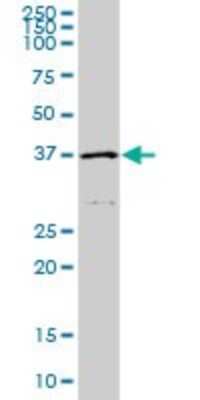 Western Blot: HFE Antibody (1G12) [H00003077-M01]
