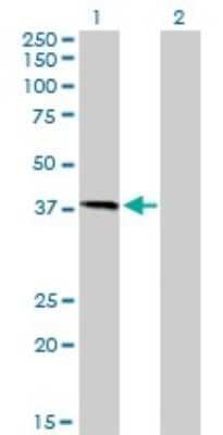 Western Blot: HFE Antibody (1G12) [H00003077-M01]