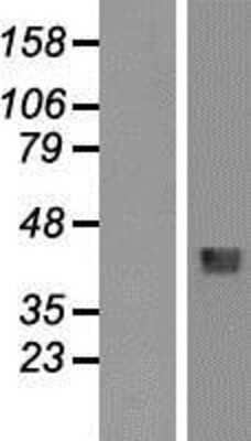 Western Blot: HFE Overexpression Lysate [NBP2-09029]