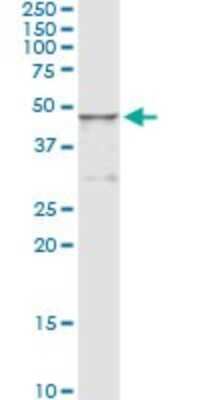 Immunoprecipitation: HGD Antibody (1F1) [H00003081-M11]