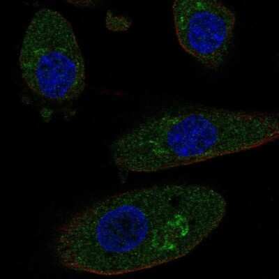 Immunocytochemistry/ Immunofluorescence: HGD Antibody [NBP2-49039]