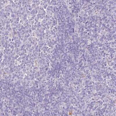 Immunohistochemistry-Paraffin: HGD Antibody [NBP2-33488]