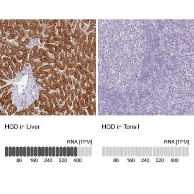 Immunohistochemistry-Paraffin: HGD Antibody [NBP2-33488]