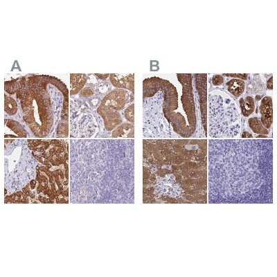 Immunohistochemistry-Paraffin: HGD Antibody [NBP2-33488]