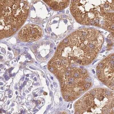 Immunohistochemistry-Paraffin: HGD Antibody [NBP2-33488]