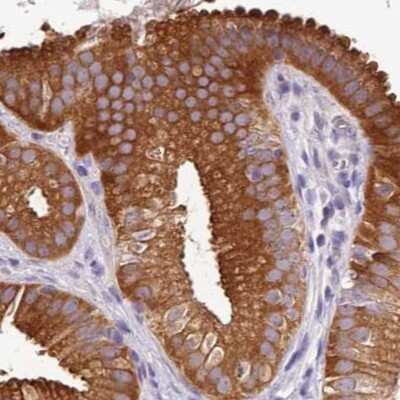 Immunohistochemistry-Paraffin: HGD Antibody [NBP2-33488]