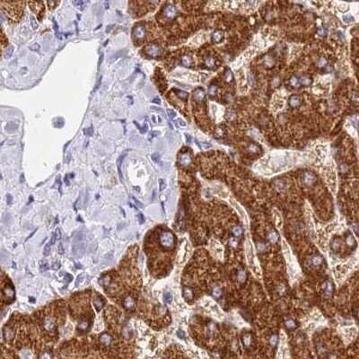 Immunohistochemistry-Paraffin: HGD Antibody [NBP2-33488]