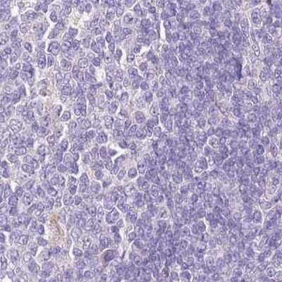 Immunohistochemistry-Paraffin: HGD Antibody [NBP2-33488]
