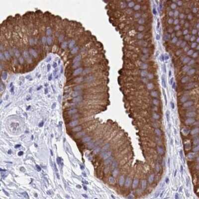 Immunohistochemistry-Paraffin: HGD Antibody [NBP2-49039]