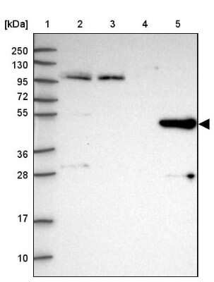 Western Blot: HGD Antibody [NBP2-33488]