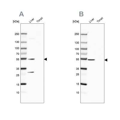 Western Blot: HGD Antibody [NBP2-33488]