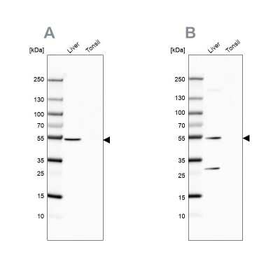 Western Blot: HGD Antibody [NBP2-49039]