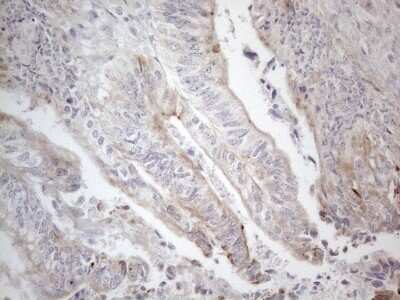 Immunohistochemistry: HGF Antibody (OTI1D2) - Azide and BSA Free [NBP2-70884]