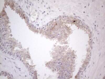 Immunohistochemistry: HGF Antibody (OTI1D2) - Azide and BSA Free [NBP2-70884]