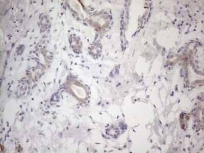 Immunohistochemistry: HGF Antibody (OTI1D2) - Azide and BSA Free [NBP2-70884]