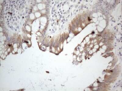Immunohistochemistry: HGF Antibody (OTI1D2) - Azide and BSA Free [NBP2-70884]