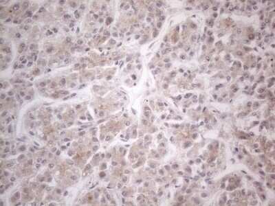 Immunohistochemistry: HGF Antibody (OTI1D2) - Azide and BSA Free [NBP2-70884]