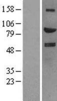 Western Blot: HGF Overexpression Lysate [NBL1-11527]