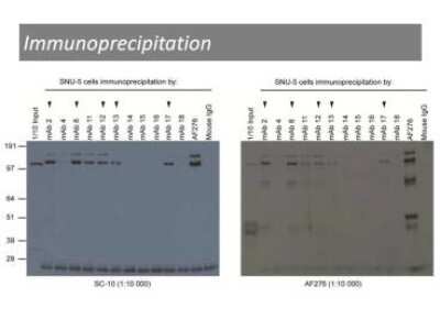 Immunoprecipitation: HGFR/c-MET Antibody (17) - BSA Free [NBP2-50171]