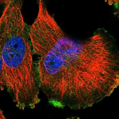 Immunocytochemistry/ Immunofluorescence: HGFR/c-MET Antibody [NBP2-55719]