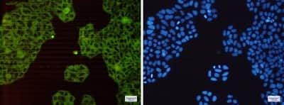 Immunocytochemistry/ Immunofluorescence: HGFR/c-MET Antibody (S02-4D6) [NBP3-14873]