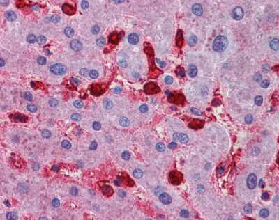 Immunohistochemistry: HGK/MAP4K4 Antibody [NBP1-58853]