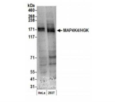 Western Blot: HGK/MAP4K4 Antibody [NB100-74630]