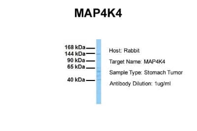 Western Blot: HGK/MAP4K4 Antibody [NBP1-58853]