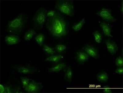 Immunocytochemistry/ Immunofluorescence: HGS Antibody (6D11) [H00009146-M01]