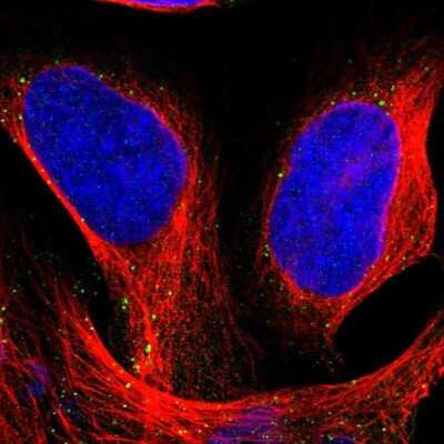 Immunocytochemistry/ Immunofluorescence: HGS Antibody [NBP1-83203]