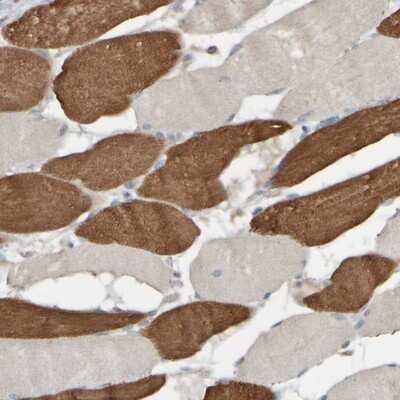 Immunohistochemistry-Paraffin: HGS Antibody [NBP1-83203]