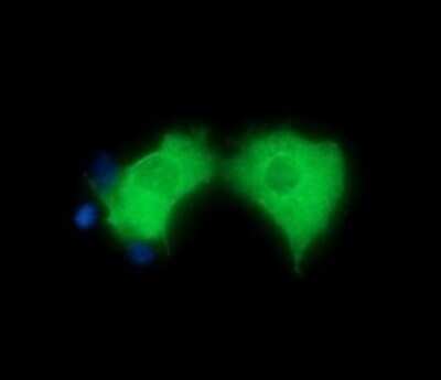 Immunocytochemistry/ Immunofluorescence: HGS Antibody (OTI3H7) - Azide and BSA Free [NBP2-71418]