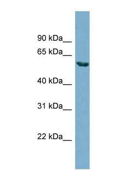 Western Blot: HHAT Antibody [NBP1-69465]