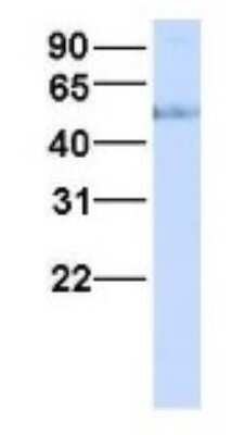 Western Blot: HHAT Antibody [NBP1-69465]