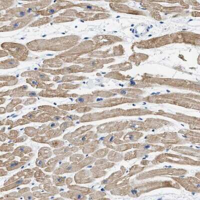 Immunohistochemistry-Paraffin: HHATL Antibody [NBP1-86791]
