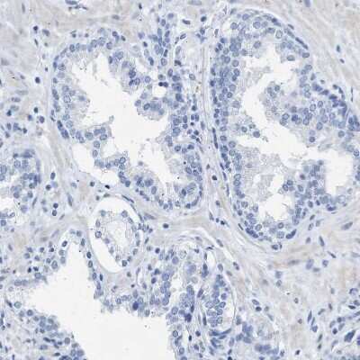 Immunohistochemistry-Paraffin: HHATL Antibody [NBP1-86791]