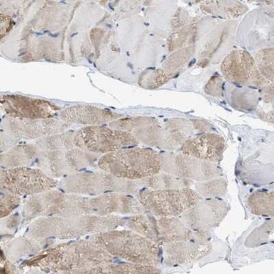 Immunohistochemistry-Paraffin: HHATL Antibody [NBP1-86791]