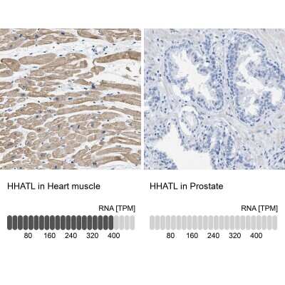 Immunohistochemistry-Paraffin: HHATL Antibody [NBP1-86791]