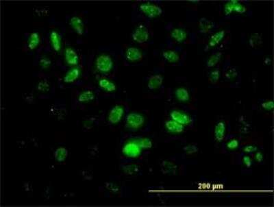 Immunocytochemistry/ Immunofluorescence: HHEX Antibody (1A5) [H00003087-M02]