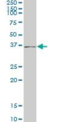 Western Blot: HHEX Antibody (1A5) [H00003087-M02]