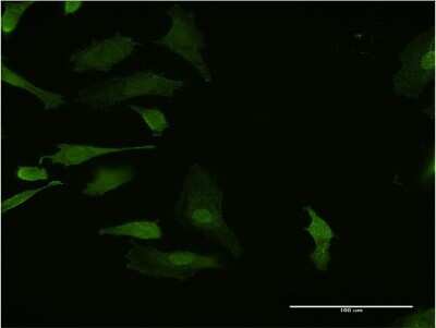 Immunocytochemistry/ Immunofluorescence: HHEX Antibody (2B12) [H00003087-M13]